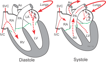 intracardiac blood flow during systole and diastole